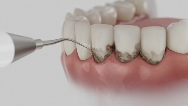 Reliable Teeth Cleaning And Checkup contractor in Lee County County, IA by Dentist Open Now